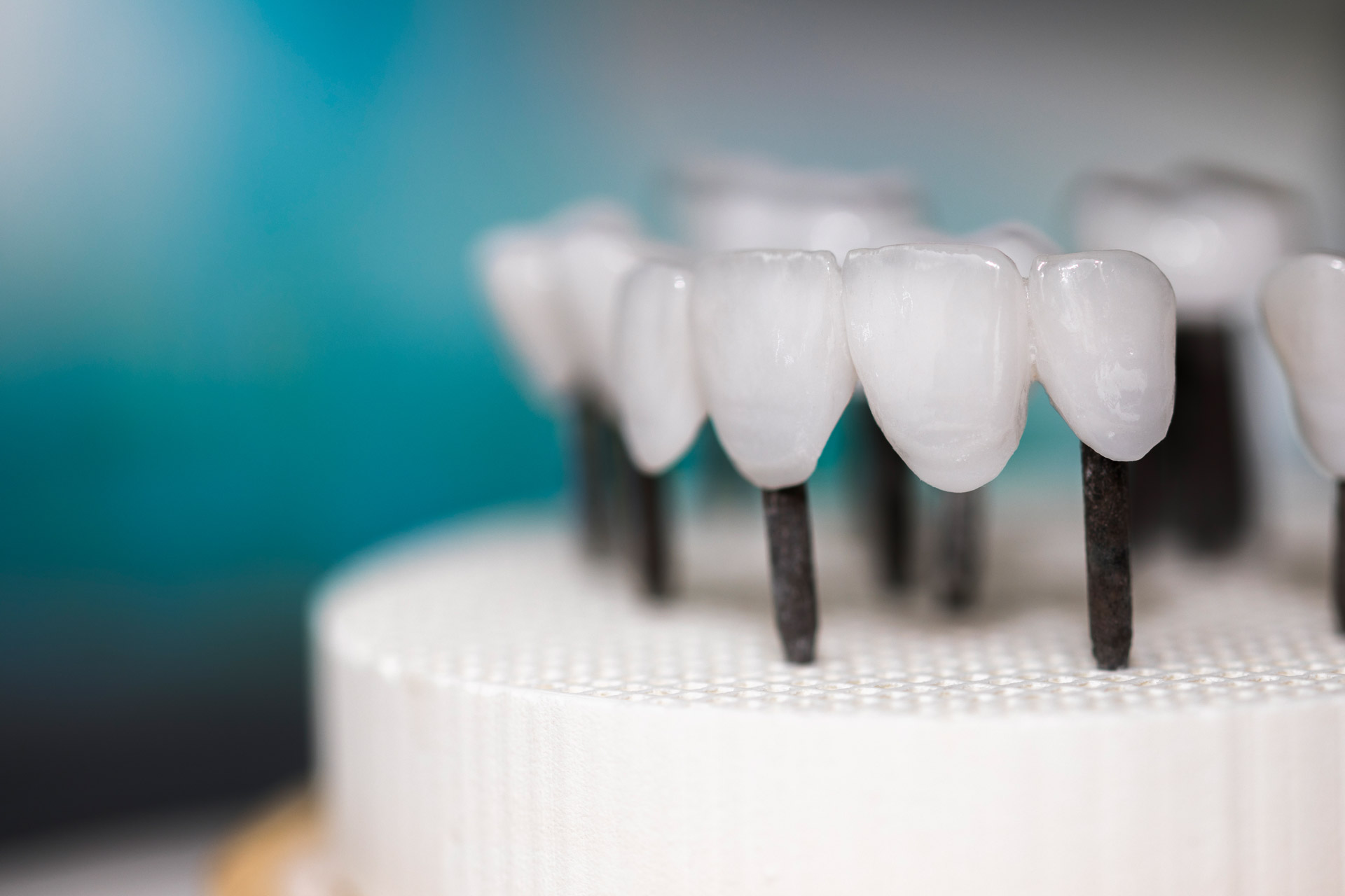 Zahntechniker prüft eine Vollkeramik-Krone im Berliner Dentallabor Zahnwerk Dreilinden